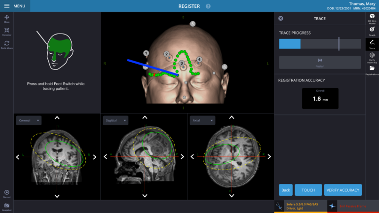 Protected: Neurosurgical Navigation